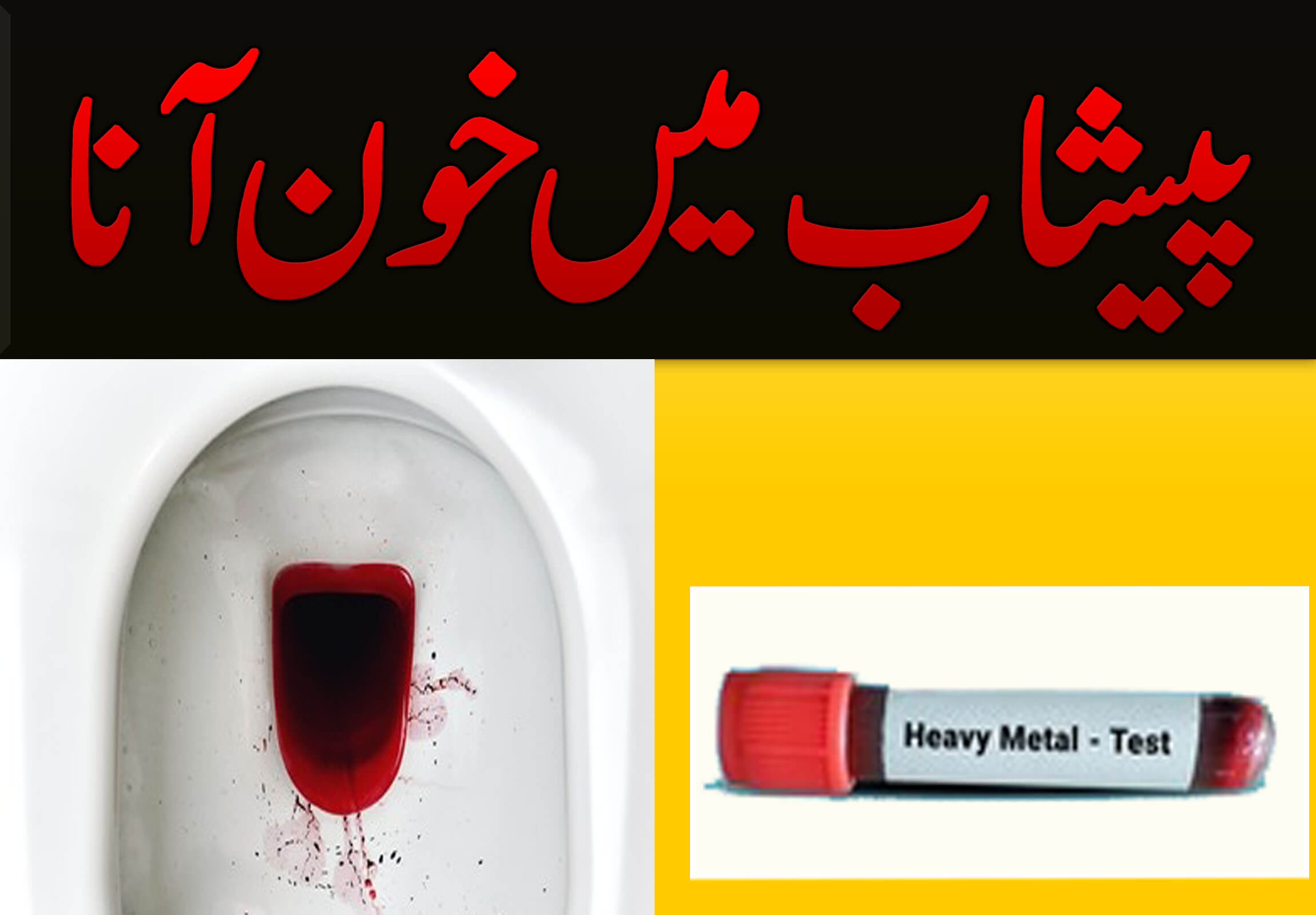پیشاب میں خون آنا