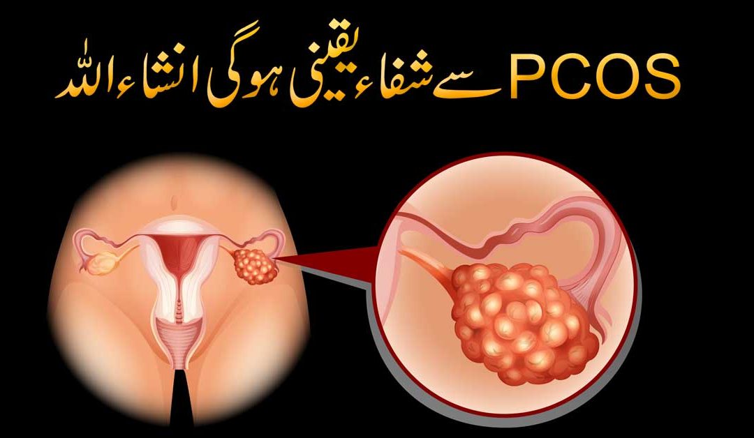PCOS Se 100% Shifa Ka Powerful Taweez