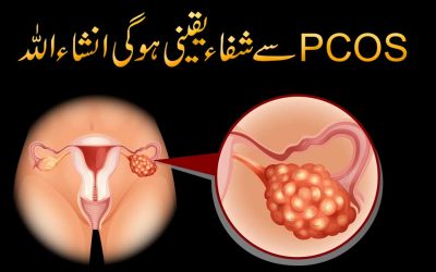PCOS Se 100% Shifa Ka Powerful Taweez | PCOS Ka Ilaj