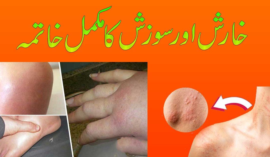 Jisam Ki Kharish Khatam Karne Ka Taweez