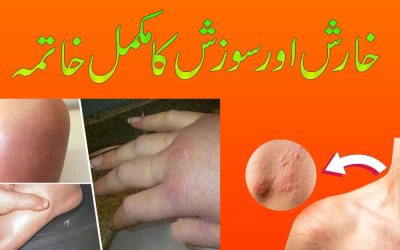 Jisam Ki Kharish Khatam Karne Ka Taweez