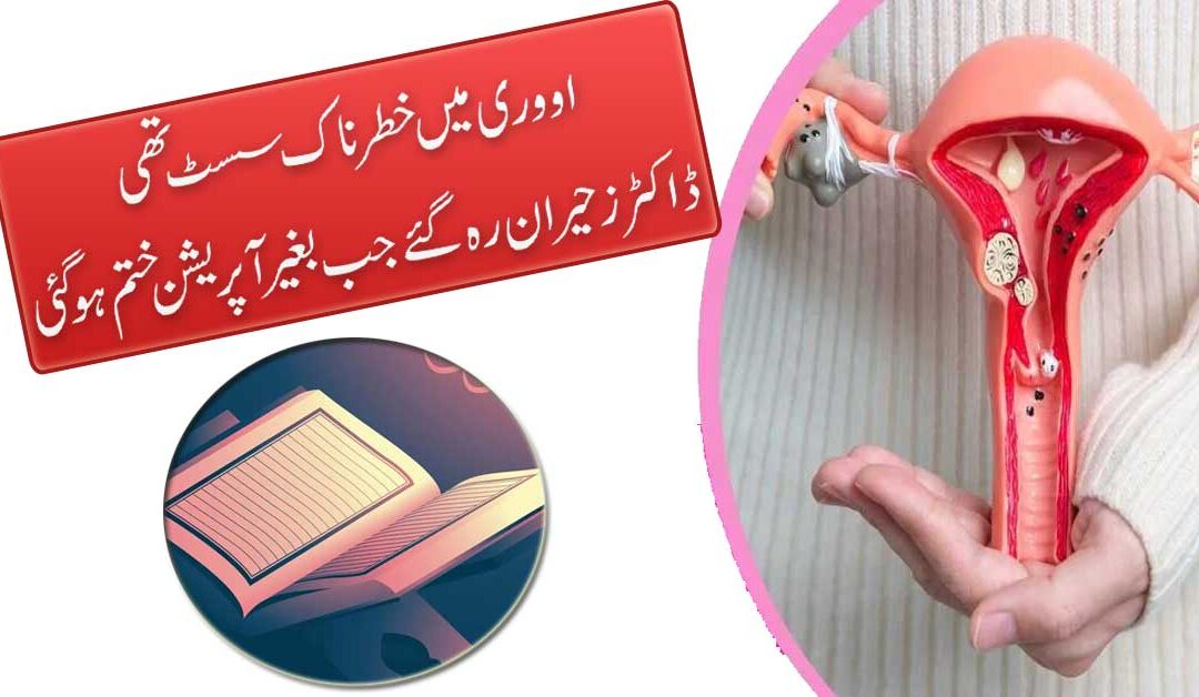 Cyst Se Shifa Ka Naqsh