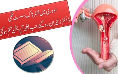 Cyst Se Shifa Ka Naqsh