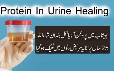 Protein In Urine Treatment